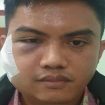 Dr. Yordani Sumomba (Doc. Dinas Kesehatan Memberamo Tengah)